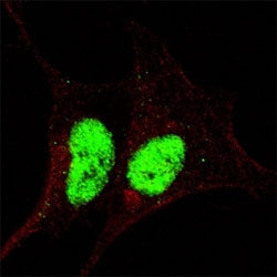 Fluorescent confocal image of SY5Y cells stained with phospho-Sox2 antibody at 1:200. The immunosign