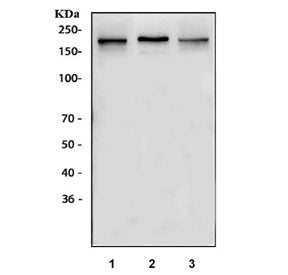 NMDAR2B Antibody / GRIN2B