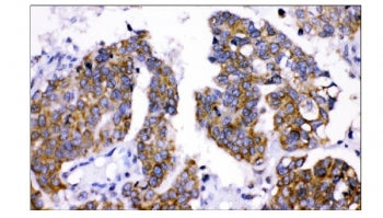 AMHR2 Antibody