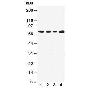 Western blot testing with MEKK3 antibody; Lane 1: HeLa; 2: A431; 3: MCF-7; 4: Jurkat cell lysate. Ex