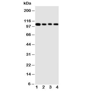 HSP105 Antibody