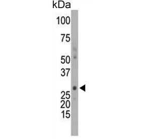 DCK Antibody / Deoxycytidine kinase
