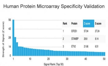Analysis of HuProt(TM) microarray containing more than 19,000 full-length human proteins using EIF2S