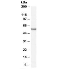 Western blot testing of human heart lysate with Histamine receptor H1 antibody at 0.5ug/ml. Predicte
