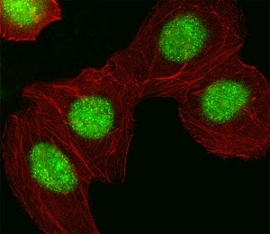 HMGA1 Antibody
