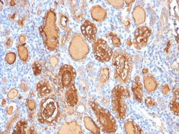 IHC: Formalin-fixed, paraffin-embedded human thyroid gland stained with recombinant Thyroglobulin an