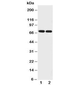 Western blot testing of Netrin 1 antibody and Lane 1: U87; 2: COLO320 cell lysate. Expected molecula