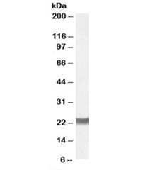 Western blot testing of human placenta lysate with SM22 alpha antibody at 0.02ug/ml. Predicted molec