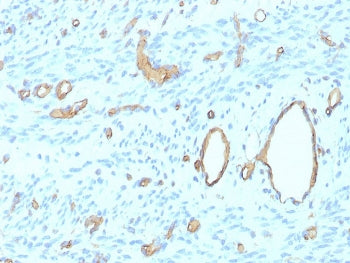 IHC staining of FFPE human uterus tissue with recombinant CD34 antibody (clone rHPCA1/8500). HIER: b