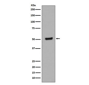 Western blot testing of lysate from human HEK293 cells treated with Calyculin A and okadaic acid, wi
