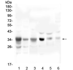Western blot testing of 1) human A549, 2) human U-2 OS, 3) human PC-3, 4) rat heart, 5) mouse heart 