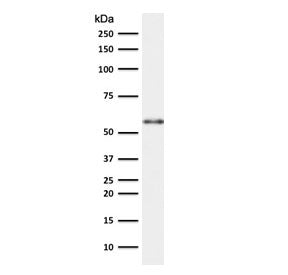 Western blot testing of human thymus lysate with Keratin 10 antibody (clone CTKN10-1). Predicted mol