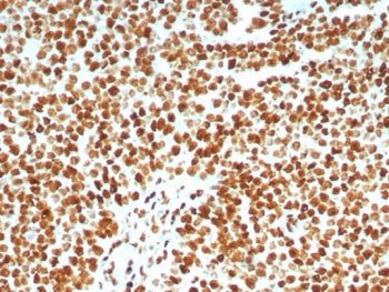 IHC staining of FFPE human lymph node tissue with Ku80 antibody (clone XRCC5/8093R). HIER: boil tiss