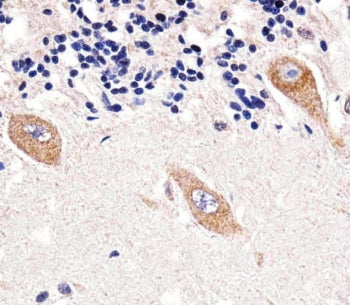 IHC testing of FFPE human cerebellum tissue with TENT2 antibody. HIER: steam section in pH6 citrate 