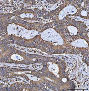 17HSD7 Antibody / HSD17B7
