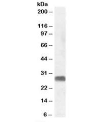 Western blot testing of human testis lysate with SRD5A2 antibody at 1ug/ml. Predicted molecular weig