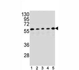 PAX1 antibody western blot analysis in (1) HepG2, (2) MDA-MB453, (3) 293, (4) K562 and (5) MCF-7 lys