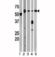 Western blot testing of Beclin antibody and (1) A2058, (2) HeLa, (3) mouse brain, (4) Y79, and (5) H
