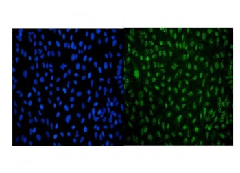 Immunofluorescent staining of FFPE human HeLa cells with LSM8 antibody (green) and DAPI nuclear stai