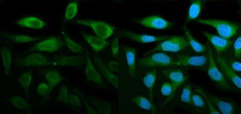 Immunofluorescent staining of FFPE human HeLa cells with STAT1 antibody (green) and DAPI nuclear sta