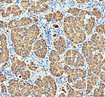 Monoamine Oxidase B Antibody / MAOB