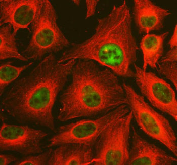 Immunofluorescent staining of TAF6 using anti-TAF6 antibody (green) and anti-Beta Tubulin antibody (