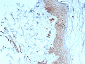 IHC staining of FFPE human skin tissue with Pan-Cadherin antibody (clone Pan-CAD/8020). HIER: boil t