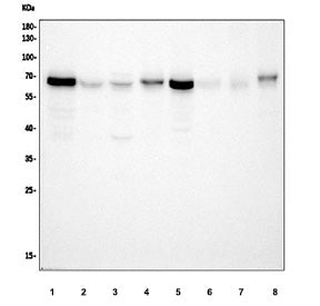 Western blot testing of PAK1 antibody and Lane 1: rat testis; 2: rat spleen; 3: SW620; 4: MCF-7; 5: 