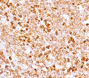 IHC testing of FFPE human tonsil with recombinant CD79a antibody (clone CDLA79a-3R). Required HIER: 