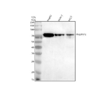 Western blot analysis of PNLIPRP3 using anti-PNLIPRP3 antibody. Electrophoresis was performed on a 1