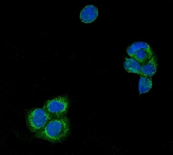 Immunofluorescent staining of FFPE human A431 cells with USP21 antibody (green) and DAPI nuclear sta