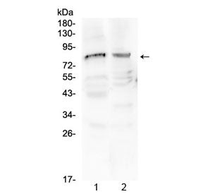 ChAT Antibody / Choline acetyltransferase