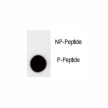 p27Kip1 Antibody (phospho-T157)