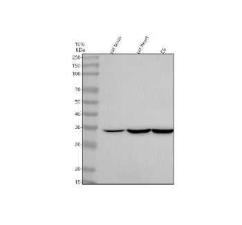 Western blot analysis of NTMT2 using anti-NTMT2 antibody. Lane 1: rat brain tissue lysates, Lane 2: 