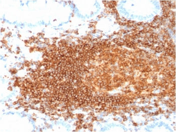 IHC staining of FFPE human lymph node with recombinant CD45RB antibody (clone rPTPRC/1132). HIER: st