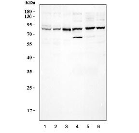 Western blot testing of 1) human HeLa, 2) K562, 3) Ramos, 4) rat brain, 5) mouse brain and 6) mouse 