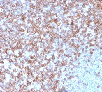 IHC staining of FFPE human spleen with CD43 antibody (clone SPN/3388). HIER: boil tissue sections in