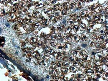 IHC testing of FFPE human spinal cord with SLIT2 antibody at 4ug/ml. HIER: steamed with pH9 Tris/EDT