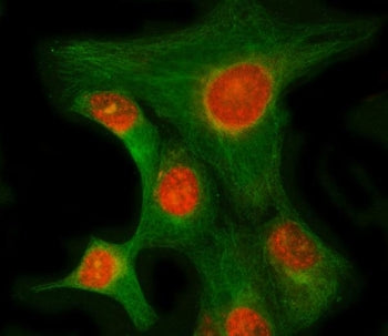 RIMKLB Antibody / Beta-citrylglutamate synthase B