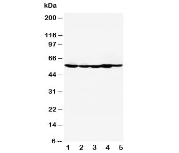 Western blot testing of HDAC2 antibody and Lane 1: MM453; 2: MCF-7; 3: HeLa; 4: SMMC-7721; 5: COLO32