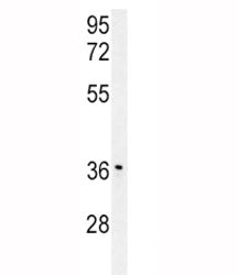 IGFBP3 western blot analysis in mouse stomach tissue lysate. The glycoprotein is visualized between 