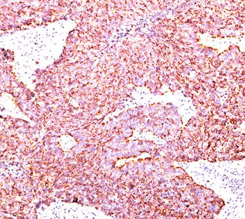 Chromogranin A Antibody