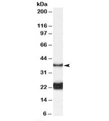 Western blot testing of rat spinal cord lysate with GALR1 antibody at 0.1ug/ml. Predicted molecular 