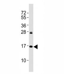 p16INK4A Antibody