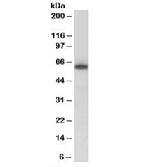 Western blot testing of nuclear Jurkat lysate with TH1L antibody at 0.5ug/ml. Predicted molecular we