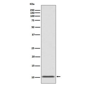 Western blot testing of human fetal pancreas with GLP-1 antibody. Predicted molecular weight ~3 kDa 