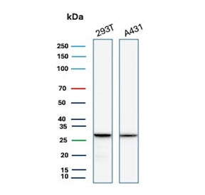 Western blot testing of human 293T and A431 cell lysate with recombinant YWHAE antibody. Predicted m