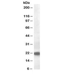 Western blot testing of rat kidney lysate with VPS25 antibody at 0.5ug/ml. Predicted molecular weigh