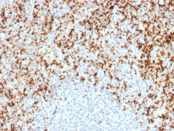 IHC testing of FFPE human spleen with ITGB3 antibody. Required HIER: boil tissue sections in 10mM Tr