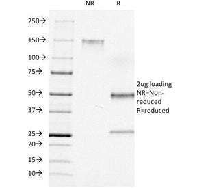 SDS-PAGE Analysis of Purified, BSA-Free CD7 Antibody (clone C7/511). Confirmation of Integrity and P
